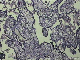 胎盘、脐带组织图22