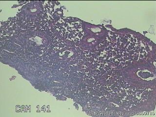 回肠末端粘膜图21