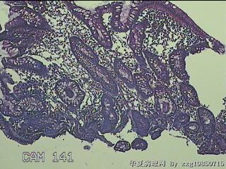 回肠末端粘膜图7
