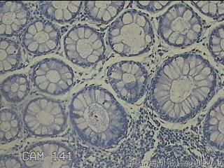 直肠粘膜图23