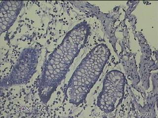 盲肠粘膜图15