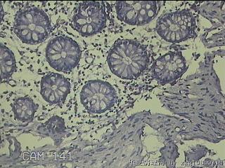 盲肠粘膜图13