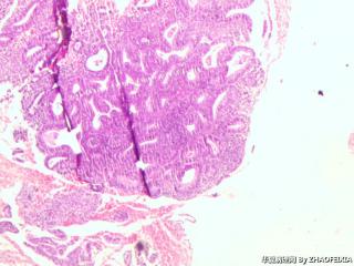 子宫内膜图3