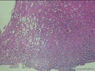 食管中段粘膜图8