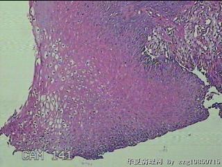 食管中段粘膜图1