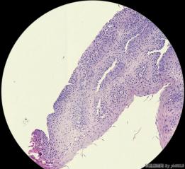 食管粘膜图5