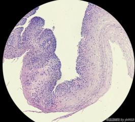 食管粘膜图3