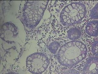 降结肠粘膜图22