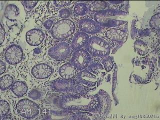 降结肠粘膜图9