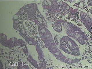 十二指肠球部粘膜图1