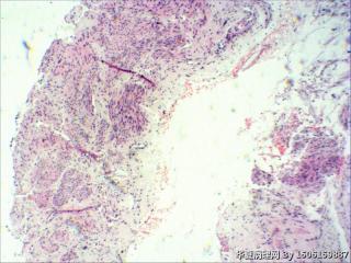 内膜组织图6