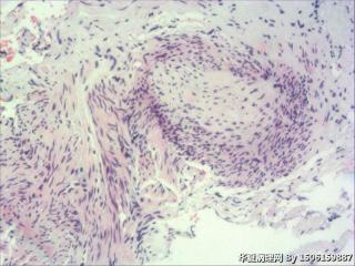 内膜组织图12