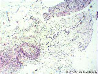 内膜组织图10
