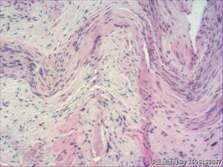 内膜组织图16