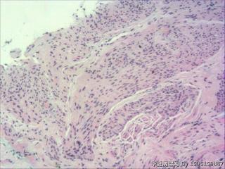 内膜组织图18