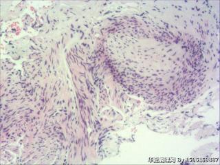 内膜组织图29