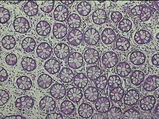 直肠粘膜图11