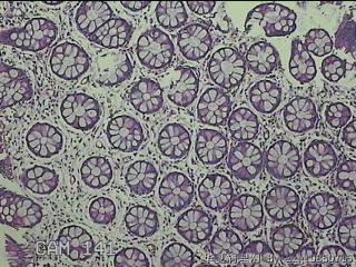 直肠粘膜图12