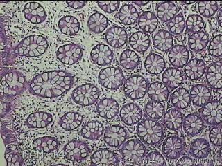 直肠粘膜图13