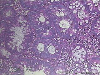 直肠粘膜图20