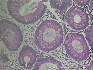 肝曲粘膜图29