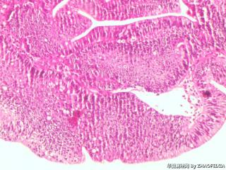 直肠组织图10