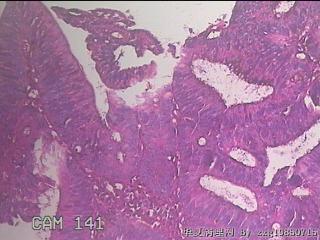 直肠粘膜图21