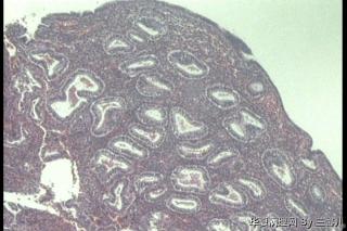 请老师看看32岁宫内膜图1