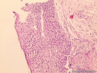 食道组织图4