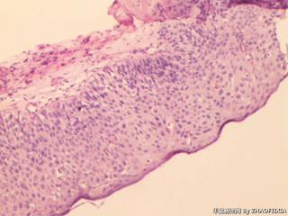 食道组织图3