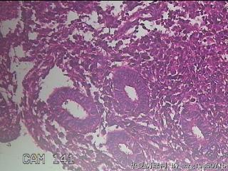 宫腔内组织图34