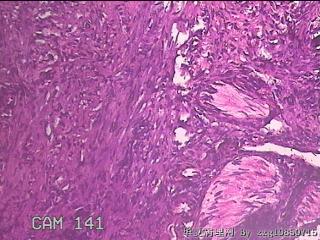 宫颈组织图47