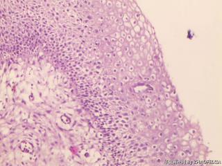 宫颈组织图8