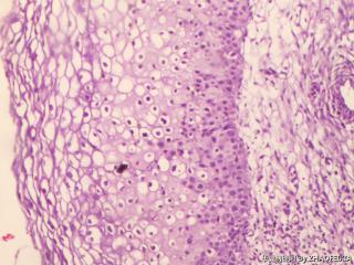 宫颈组织图6