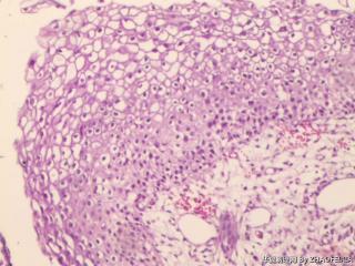 宫颈组织图10