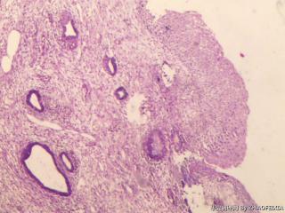 宫颈组织图3