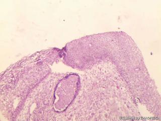 宫颈组织图2