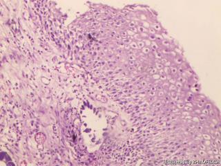 宫颈组织图13