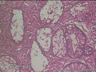 横结肠粘膜图35