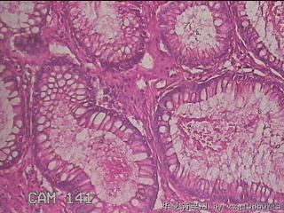 横结肠粘膜图31