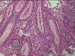 脾曲粘膜图16