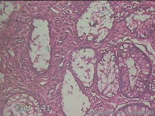 横结肠粘膜图45