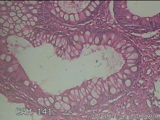 横结肠粘膜图40