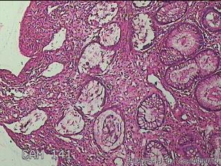 横结肠粘膜图17