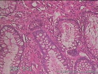 横结肠粘膜图38