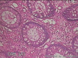 横结肠粘膜图18