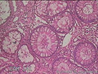 横结肠粘膜图36