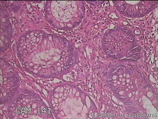 横结肠粘膜图20