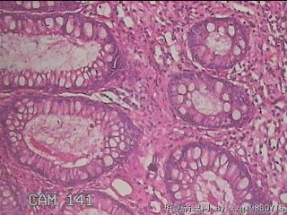 横结肠粘膜图24