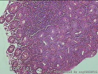 降结肠粘膜图2